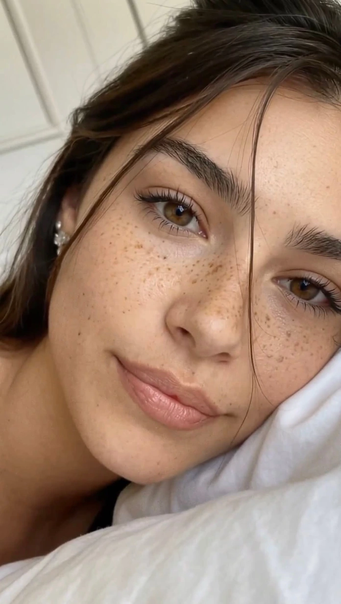 Freckles-1